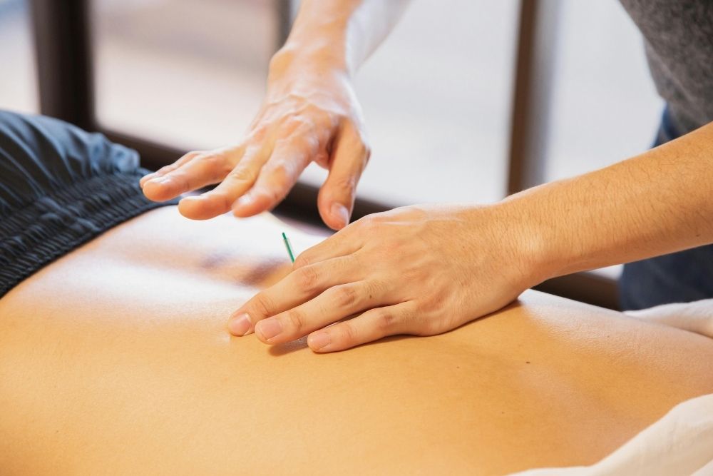 A close-up of a recovery acupuncture session used to treat inflammation and restore the body.