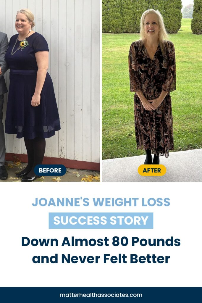 Before and after photos of Joanne Slingwine with text overlay reading "Joanne's Weight Loss Success Story: Down Almost 80 Pounds and Never Felt Better"